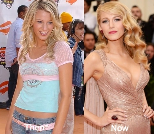A picture of Blake Lively before and after.